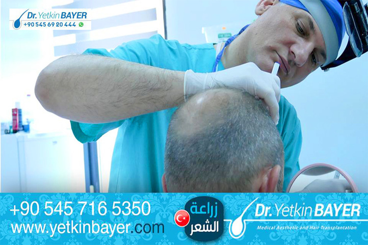 Hair Transplantation in Turkey | Dr. Yetkin Bayer | Beyoğlu | İstanbul